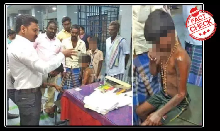 Photo Of Tamil Nadu Student With Acid Burns Viral With False Communal Claim