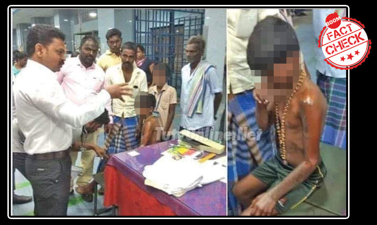 Photo Of Tamil Nadu Student With Acid Burns Viral With False Communal Claim Photo Of Tamil Nadu Student With Acid Burns Viral With False Communal Claim