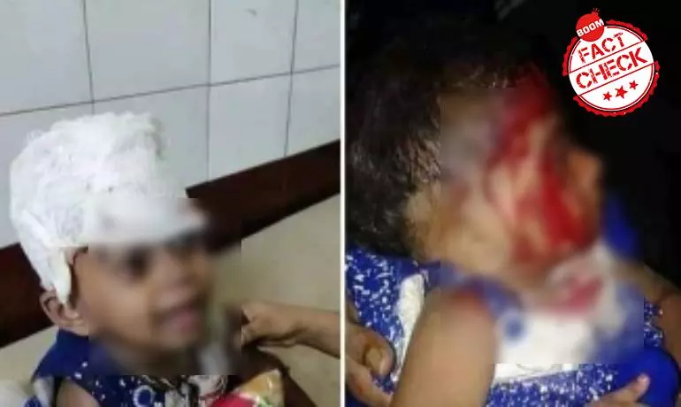 Photos Of Injured Child Are Not From Anti-CAA Protests In West Bengal