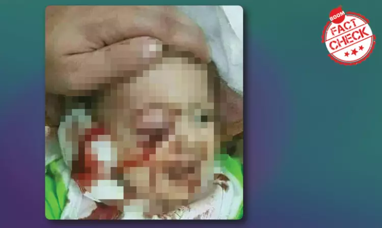 Injured Toddler Picture Not Linked To Citizenship Amendment Act Protests