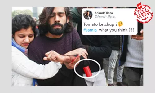 No, Anti-CAA Protester Injured In Jamia Shooting Did Not Fake His Injury