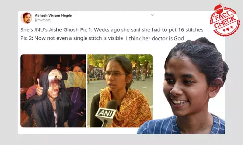 Photo Shows JNUs Aishe Ghosh Faked An Injury? False Claim Viral