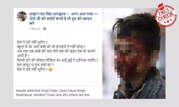 Old Image of Wounded Syrian Kid Resurfaces As Delhi Riots Victim