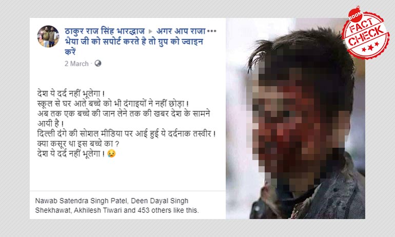 Old Image of Wounded Syrian Kid Resurfaces As Delhi Riots Old Image of Wounded Syrian Kid Resurfaces As Delhi Riots