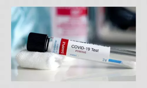 COVID-19 Test: All You Need To Know How It Is Done