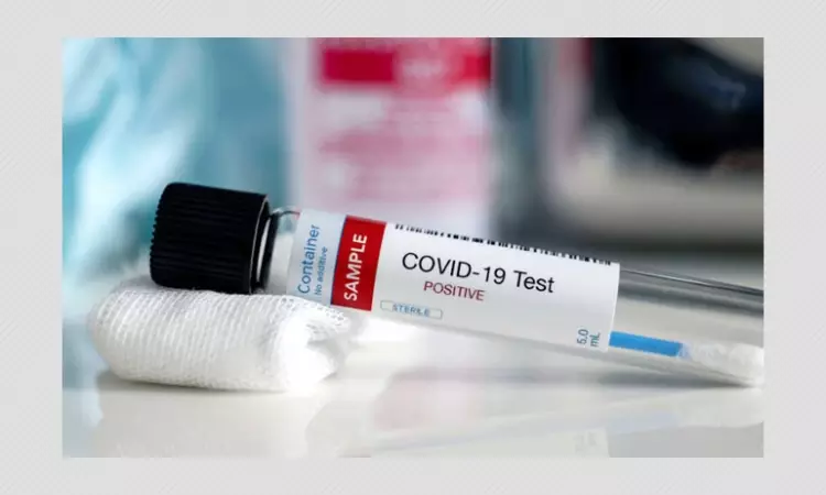 COVID-19 Test: All You Need To Know How It Is Done