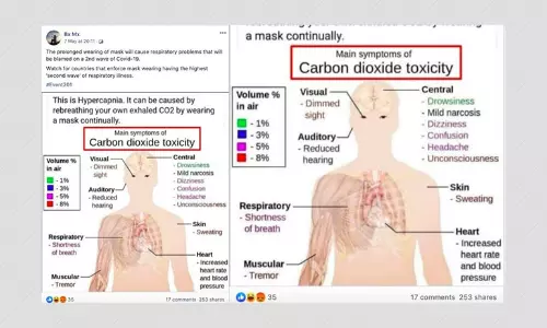 Can Prolonged Use Of Face Masks Cause Hypercapnia? A Fact Check