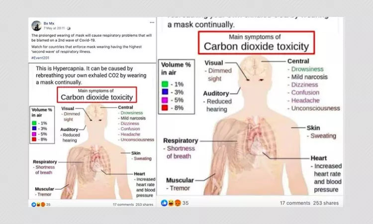 Can Prolonged Use Of Face Masks Cause Hypercapnia? A Fact Check