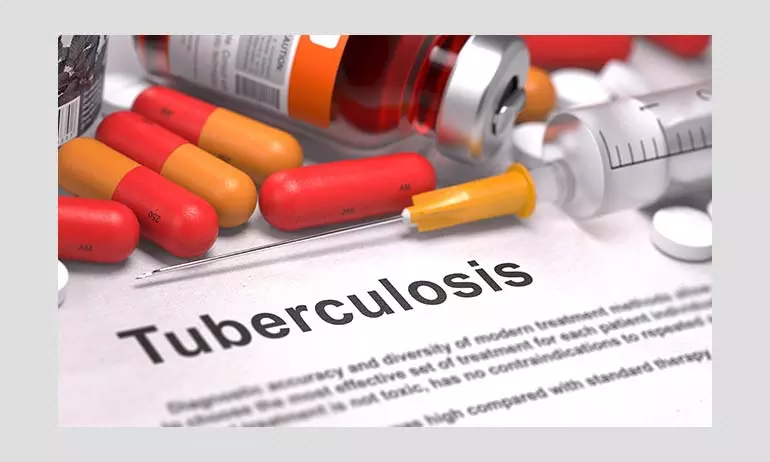 COVID-19 Has Hampered Indias Tuberculosis Fight: Dr Madhukar Pai