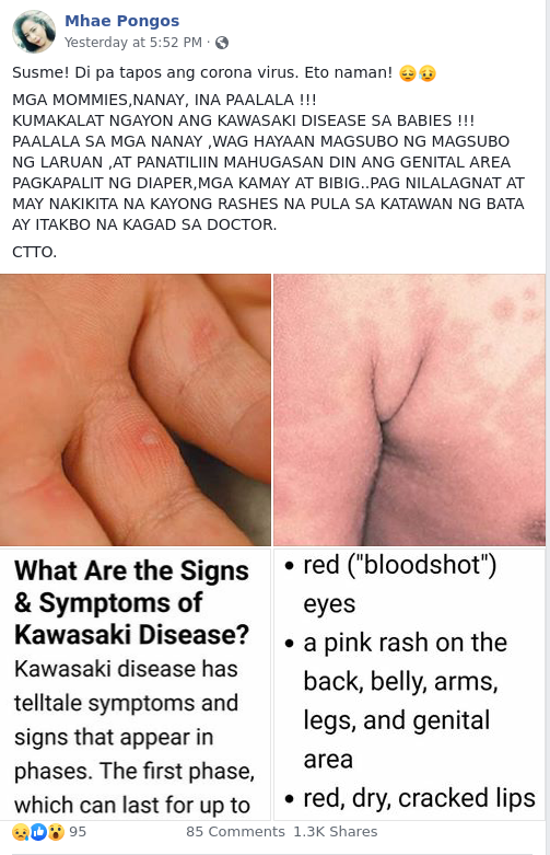 Are Babies Contracting Kawasaki The COVID-19 Pandemic? | BOOM