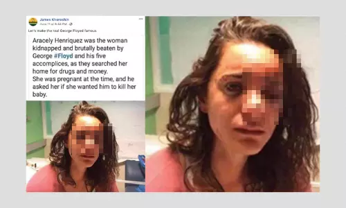 Misleading Photo Of Injured Woman Shared To Discredit George Floyd