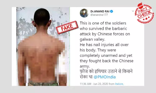 No, Photo Does Not Show Indian Soldier Injured In India-China Clash