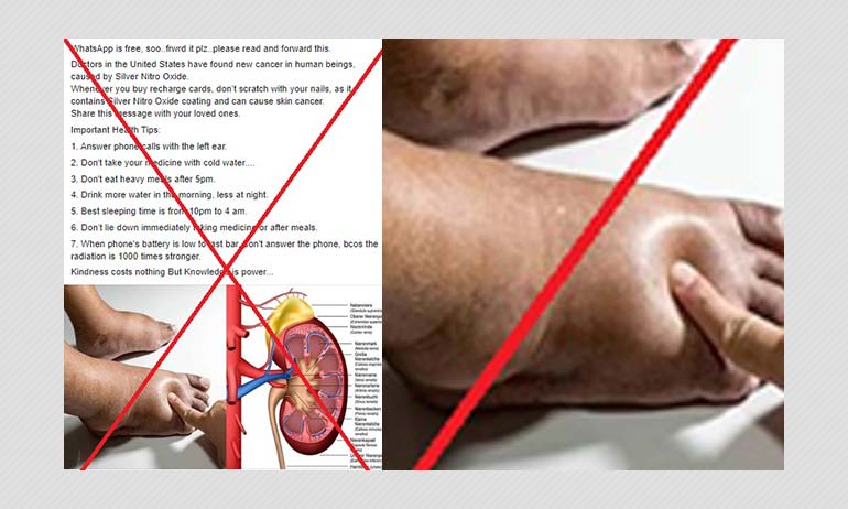 Cancer-causing "Silver Nitro Oxide" Does Not Exist As Posts Falsely Claim Cancer-causing "Silver Nitro Oxide" Does Not Exist As Posts Falsely Claim