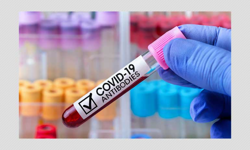 Mumbai Sero-Survey: 57% In Slums, 16% In Non-Slums Exposed To COVID-19 Virus