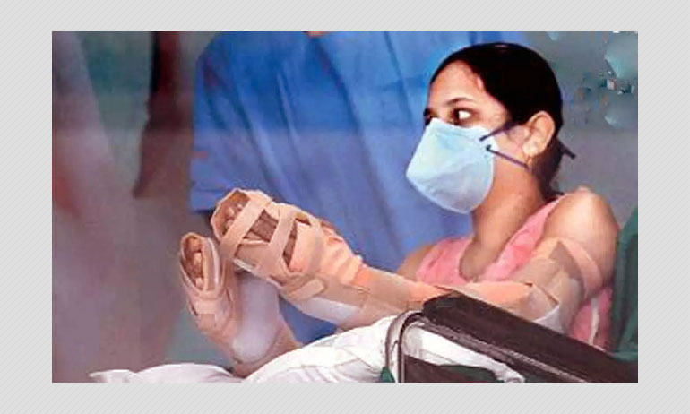 Hand Transplantations In India And Their Challenges Hand Transplantations In India And Their Challenges