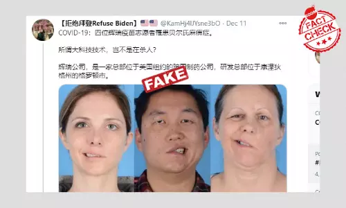 Old Photos Shared As COVID-19 Vaccine Volunteers Developing Paralysis