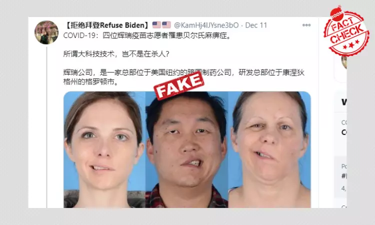 Old Photos Shared As COVID-19 Vaccine Volunteers Developing Paralysis