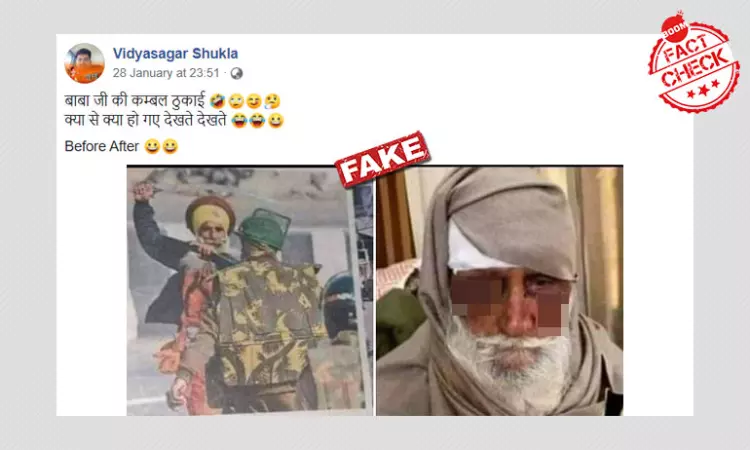 Unrelated Images Peddled As Farmer Injured After Clash With Police