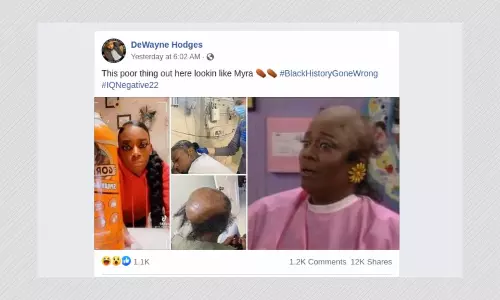 Was Gorilla Glue Girl Forced To Go Bald After Hair Drama? Not Really