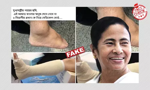 Old Image Peddled As Mamata Banerjees Injured Leg