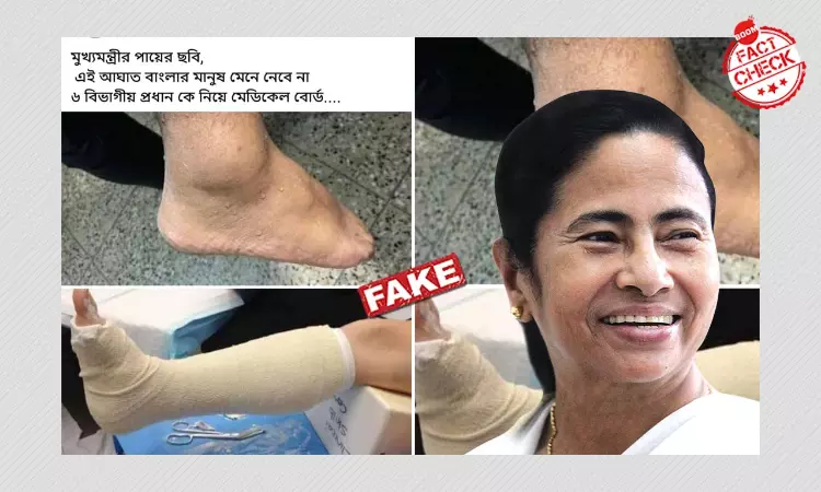 Old Image Peddled As Mamata Banerjees Injured Leg