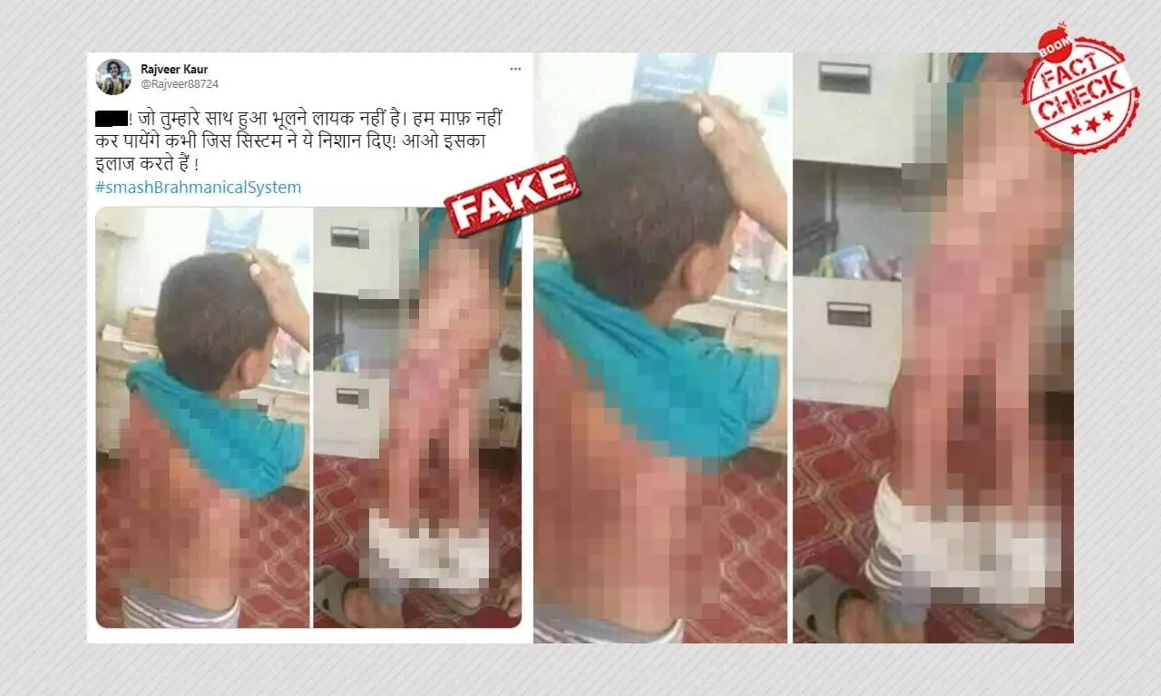 No, These Are Not Photos Of The Minor Boy Assaulted In Ghaziabad