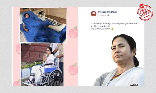 No, Mamata Banerjee Did Not Fake Her Injury; Viral Pic Is Flipped