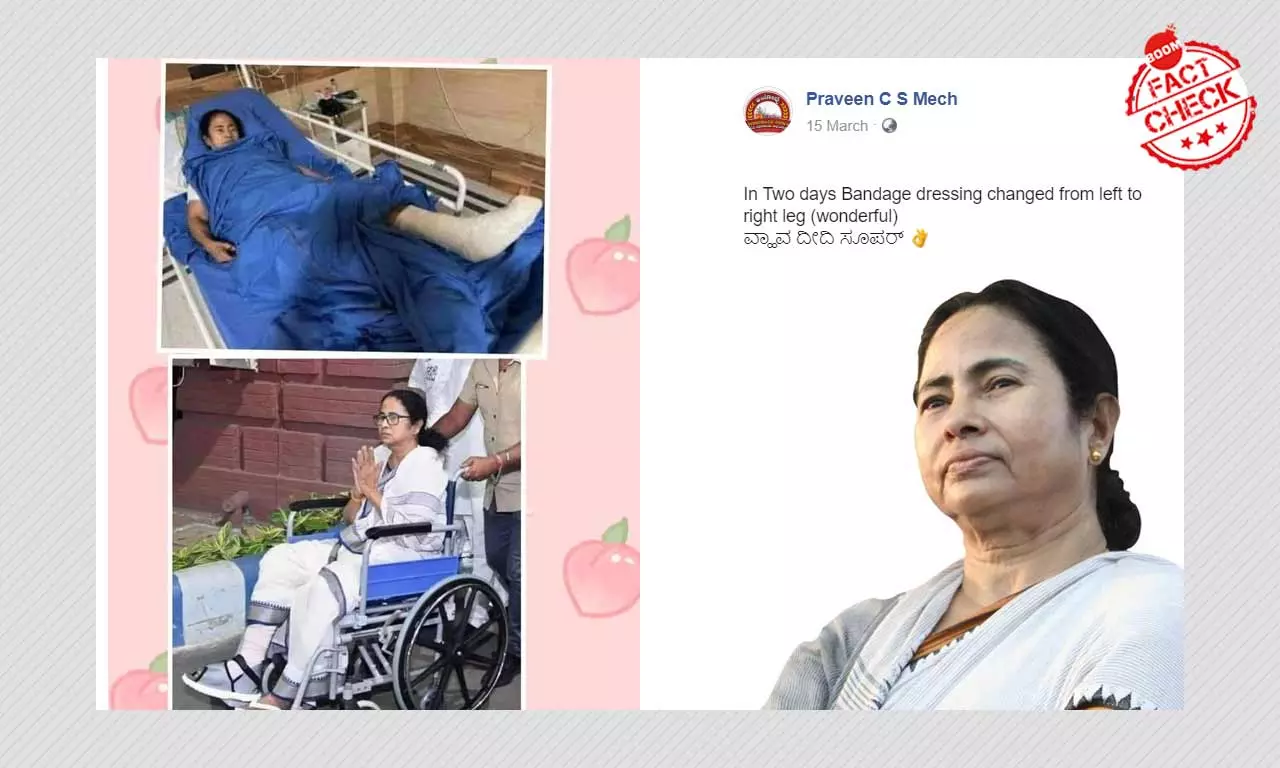 No, Mamata Banerjee Did Not Fake Her Injury; Viral Pic Is Flipped