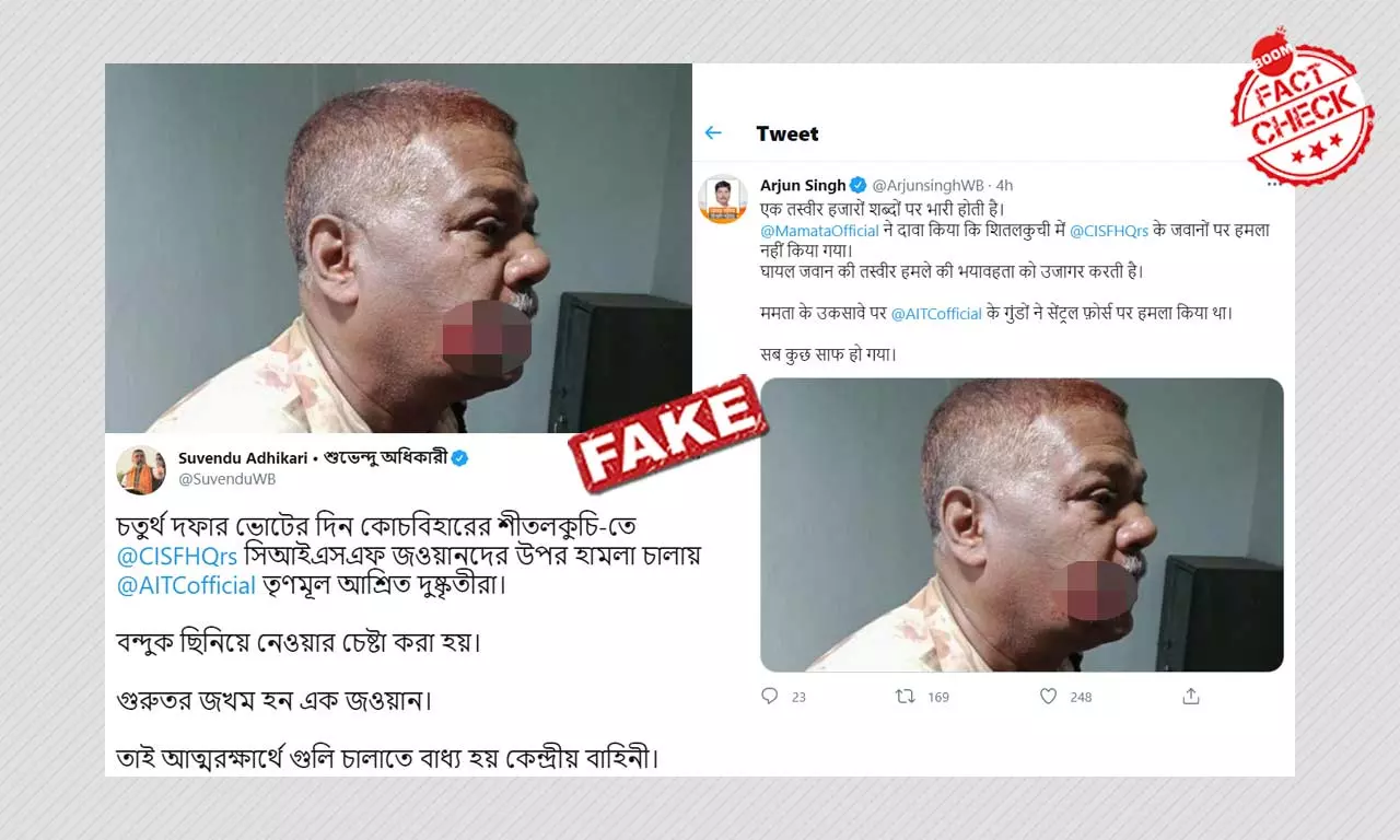 BJP Bengal Leaders Share Photo Of Injured CISF Jawan With Fake Claim