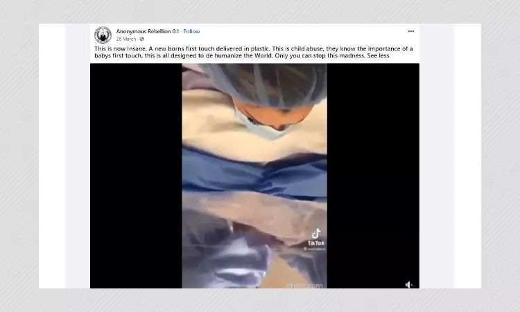 Video Of Routine Birth Procedure Falsely Shared As COVID-19 Abuse