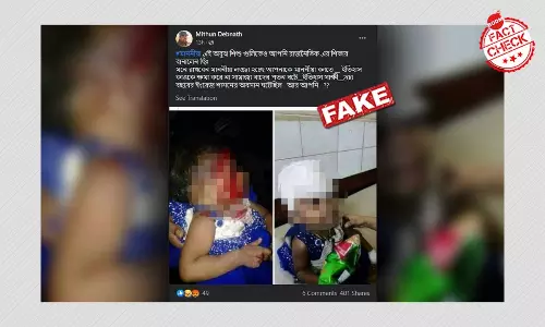 Old Pic Of Injured Child In Bangladesh Peddled As WB Political Violence