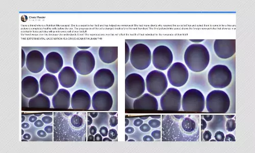 Unrelated Images Falsely Shared As Blood Cells Damages By COVID-19 Vaccine