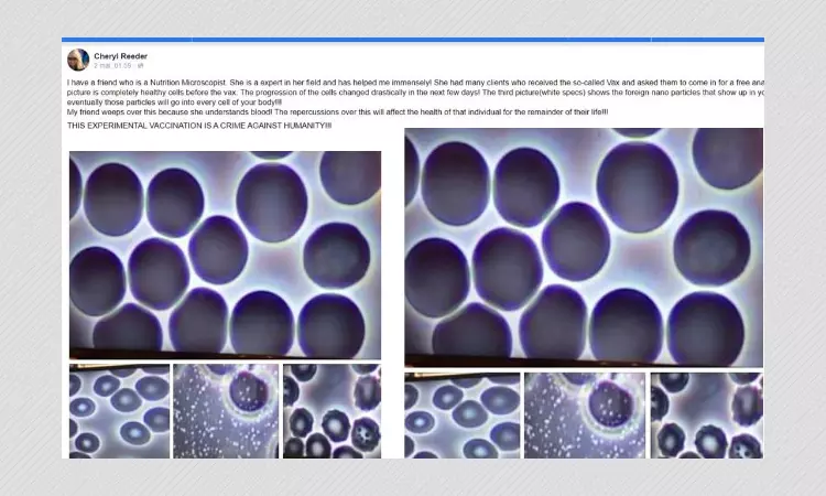 Unrelated Images Falsely Shared As Blood Cells Damages By COVID-19 Vaccine