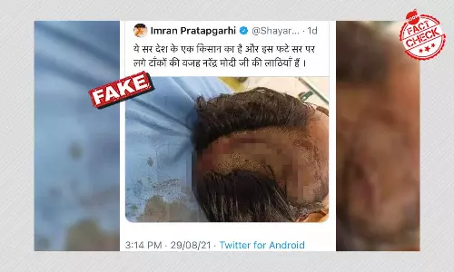 Image Of Injured Cow Vigilante Falsely Linked To Farmers Protest