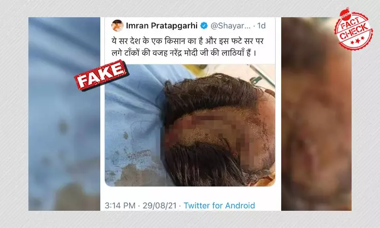Image Of Injured Cow Vigilante Falsely Linked To Farmers Protest