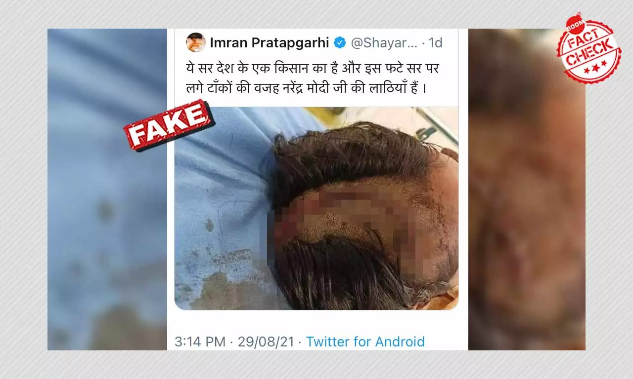 Image Of Injured Cow Vigilante Falsely Linked To Farmers Protest