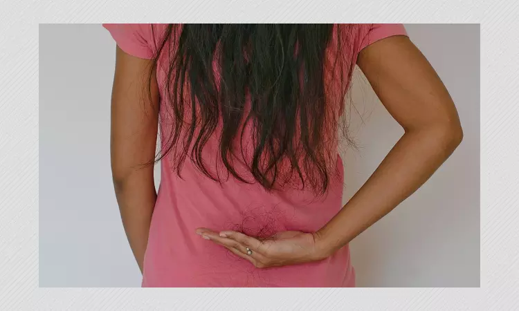 Explained: Increased Hair Fall  Post COVID-19? Is It Reversible?