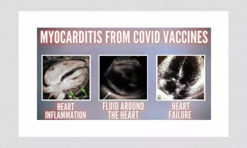 Study Cited To Claim COVID-19 Shots Are Dangerous Is Flawed