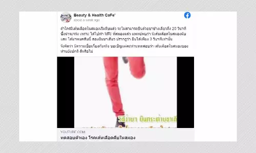 Stroke Cannot Be Diagnosed By Standing On One Leg, Experts Say