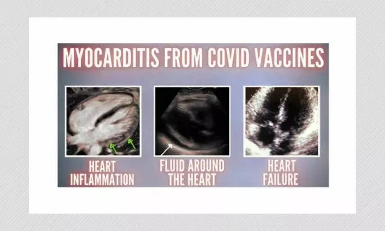 Study Cited To Claim COVID-19 Shots Are Dangerous Is Flawed