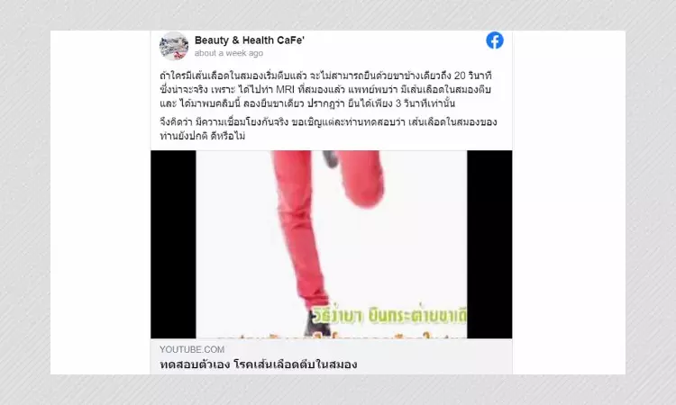 Stroke Cannot Be Diagnosed By Standing On One Leg, Experts Say