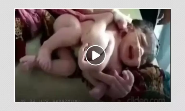 This Video of Baby From India Does Not Show Vaccine Side-Effects