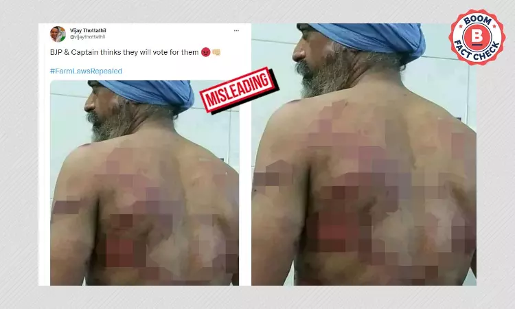 Old Photo Of Man Assaulted By Police Revived And Linked To Farmers Protest