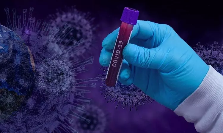 No, White Trails Left Behind By Passing Plane In Sky Do Not Spread Covid-19