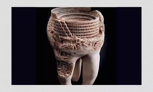 Digital Art Falsely Shared As Colosseum Carved On Human Tooth