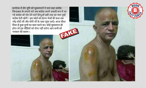 2018 Image Of Injured Jain Monk Revived With Communal Twist 2018 Image Of Injured Jain Monk Revived With Communal Twist