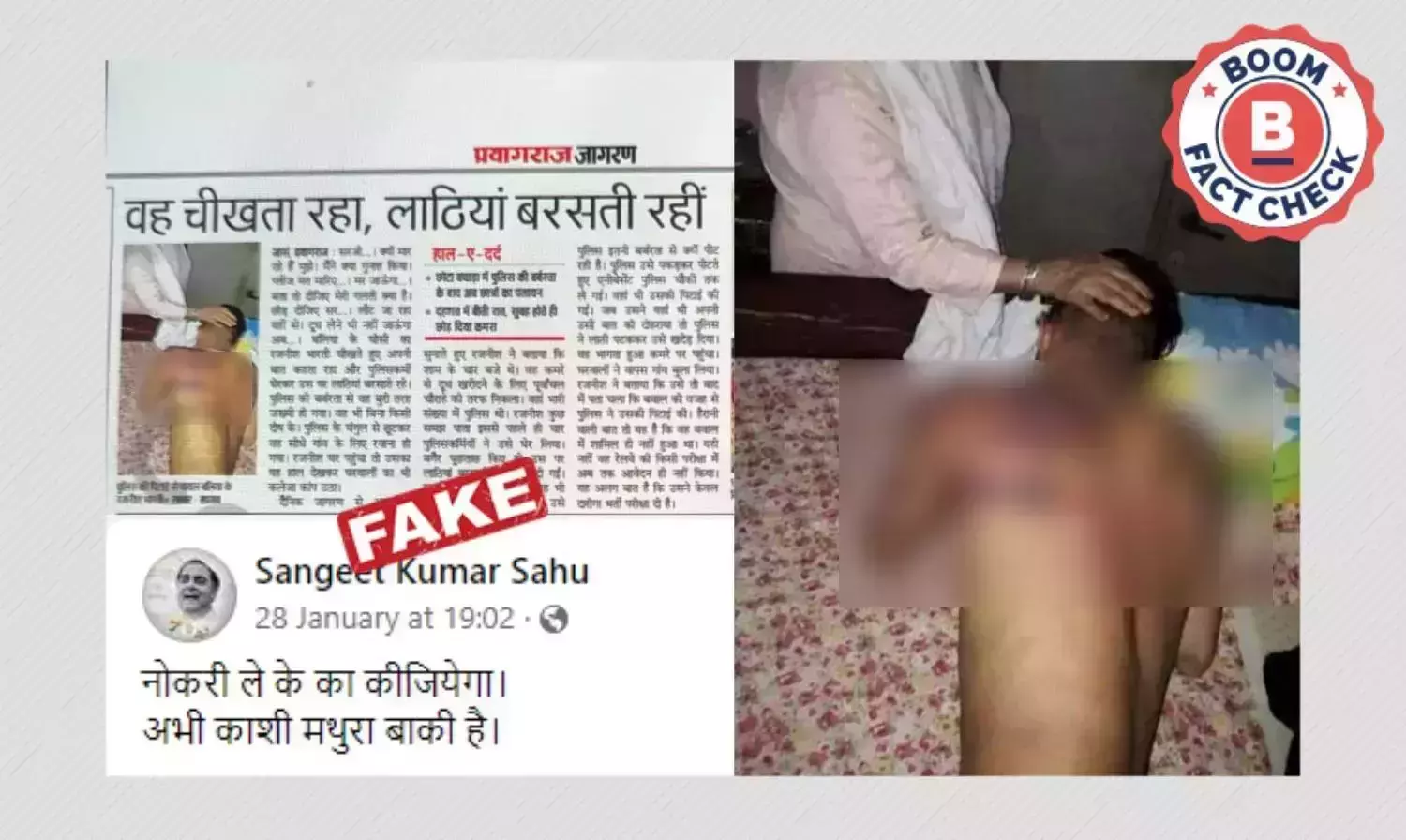2019 Image Of Injured Man Falsely Linked To Recent RRB NTPC Protest