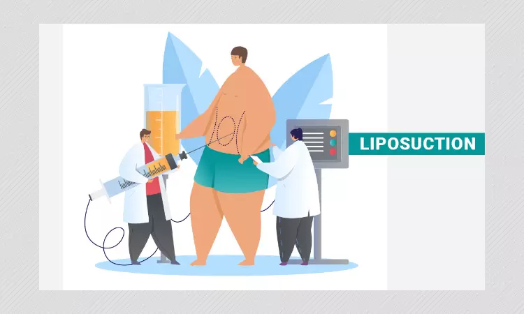 Explained: What Is Liposuction That Led To Actress Chethana Rajs Death