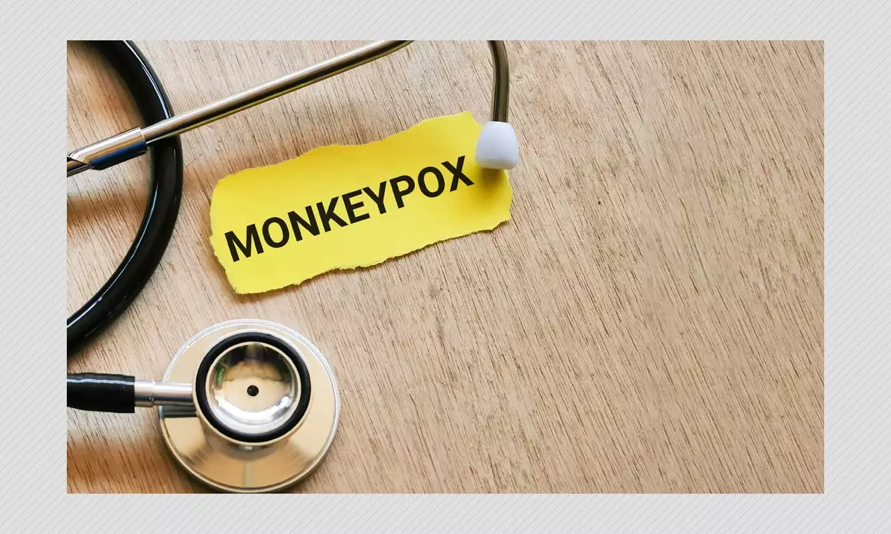 Monkeypox: Why Non-Discriminatory, Non-Stigmatising Name For Virus Is Needed