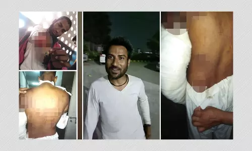 POCSO Court Acquits Muslim Man Whose Arm Was Amputated In Alleged Hate Crime